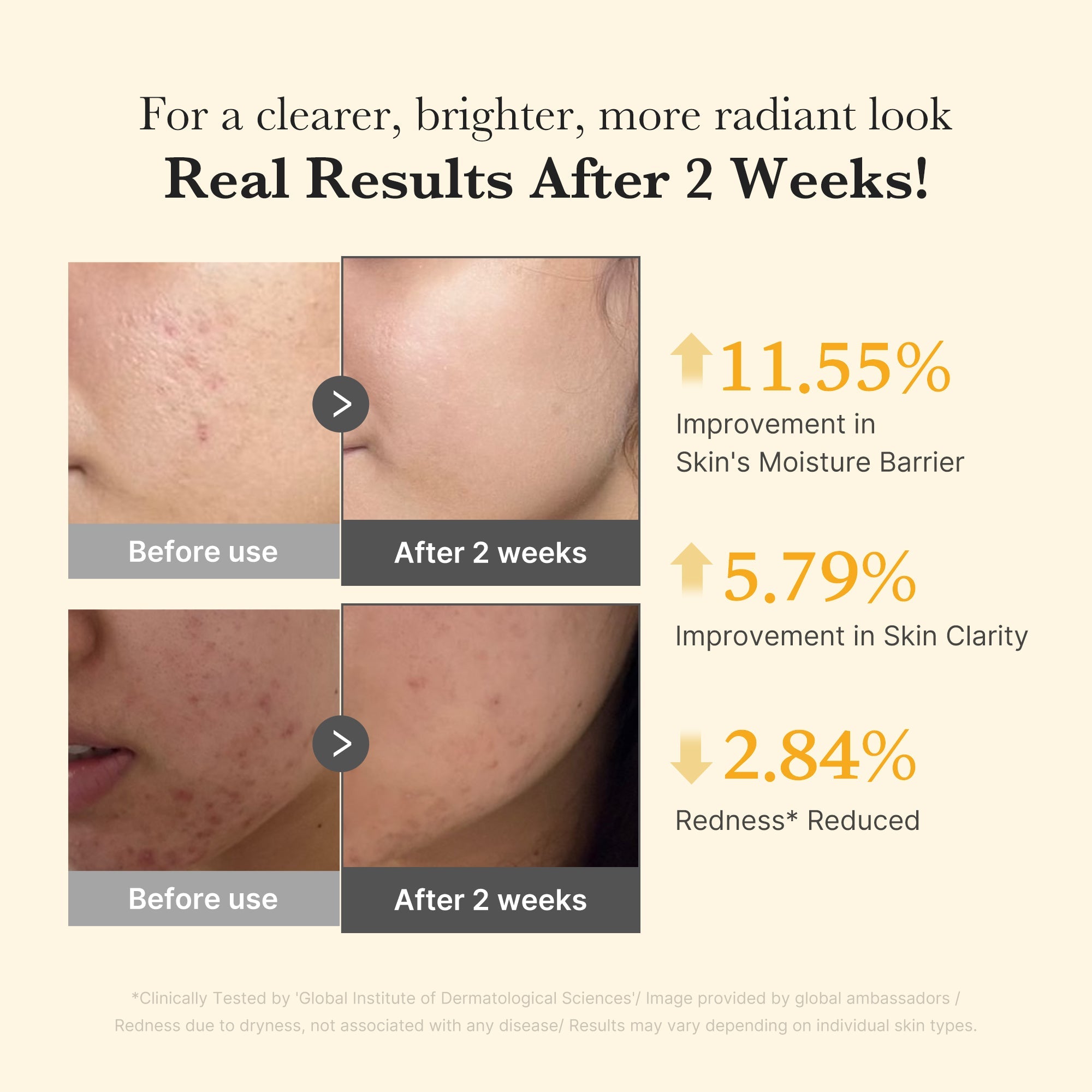 [GIFT] Kojic Acid Turmeric Capsule Serum