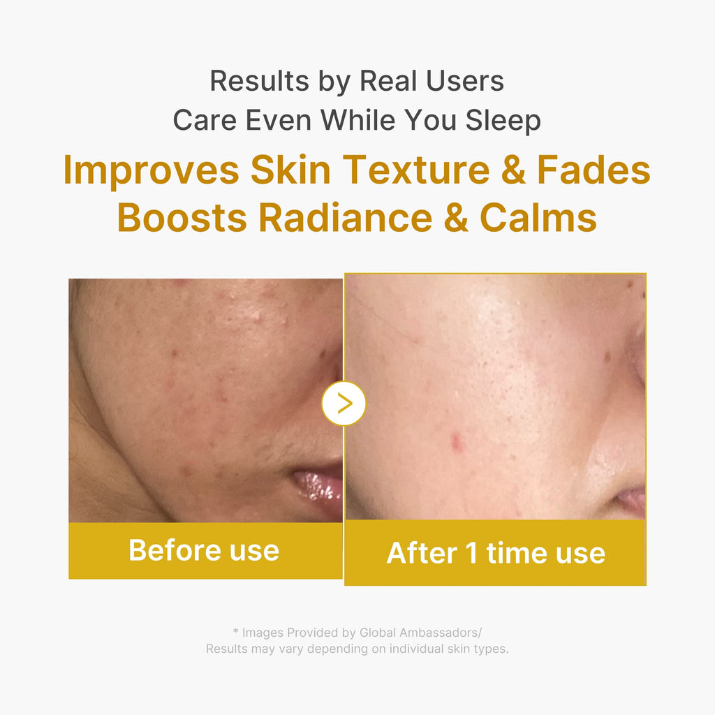 Kojic Acid Turmeric Overnight Wrapping Mask